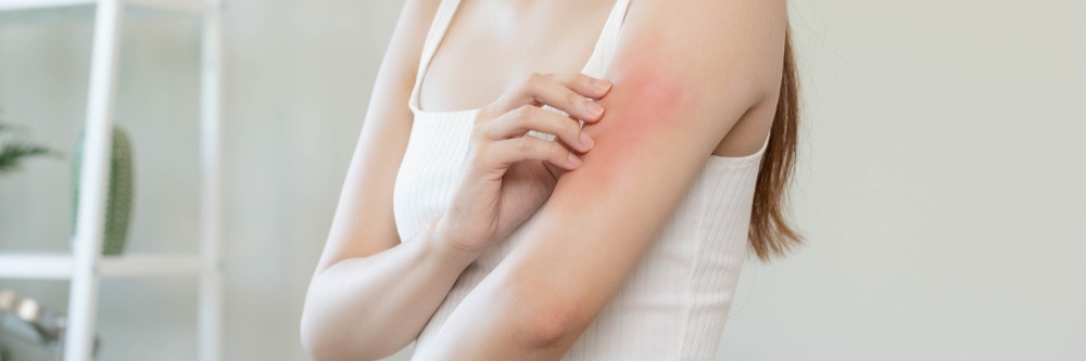 Itching and Irritated Skin